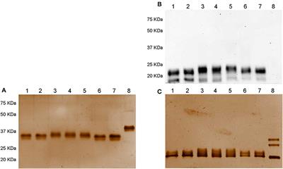 Glycosylation Pattern and in vitro Bioactivity of Reference Follitropin alfa and Biosimilars